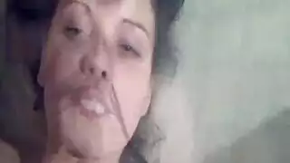 مبتور اليد الإحليل البروستات